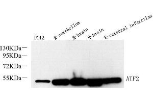 Western Blot analysis of various samples using ATF2 Polyclonal Antibody at dilution of 1:600. (ATF2 antibody)