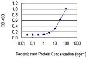 Detection limit for recombinant GST tagged PDLIM1 is 1 ng/ml as a capture antibody. (PDLIM1 antibody  (AA 123-232))