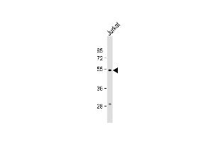 Anti-C13orf18 Antibody (Center) at 1:1000 dilution + Jurkat whole cell lysate Lysates/proteins at 20 μg per lane. (C13orf18 antibody  (AA 379-405))