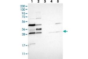 Western blot analysis of Lane 1: RT-4, Lane 2: U-251 MG, Lane 3: Human Plasma, Lane 4: Liver, Lane 5: Tonsil with RRP15 polyclonal antibody  at 1:250-1:500 dilution. (RRP15 antibody)