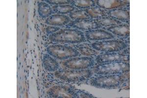 #VALUE! (CHN2 antibody  (AA 101-323))
