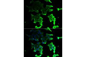 Immunofluorescence analysis of HeLa cell using TANK antibody. (TANK antibody)