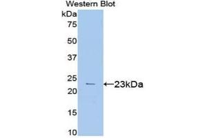 Western Blotting (WB) image for anti-Vascular Endothelial Growth Factor A (VEGFA) (AA 27-146) antibody (ABIN1715911)