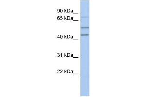 WB Suggested Anti-NEDD1 Antibody Titration: 0. (NEDD1 antibody  (N-Term))