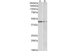 ABIN570910 (0. (GATA3 antibody  (N-Term))