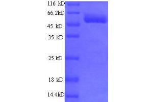 Exostoses (Multiple)-Like 3 (EXTL3) (AA 2-245), (partial) protein (GST tag)