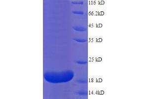 SDS-PAGE (SDS) image for Interleukin 18 Binding Protein (IL18BP) (AA 31-183), (partial) protein (His tag) (ABIN5713052)