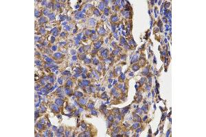 Immunohistochemistry (IHC) image for anti-Ribosomal Protein L5 (RPL5) antibody (ABIN1874650) (RPL5 antibody)
