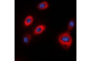 Immunofluorescent analysis of TPH1 staining in HepG2 cells. (Tryptophan Hydroxylase 1 antibody  (N-Term))