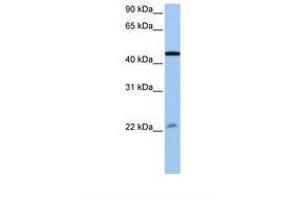 Image no. 1 for anti-Ewing Sarcoma Breakpoint Region 1 (EWSR1) (AA 173-222) antibody (ABIN6737947) (EWSR1 antibody  (AA 173-222))