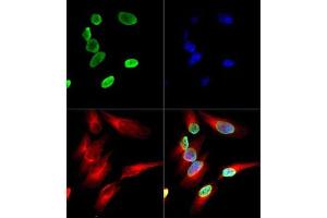 Immunofluorescence of Histone H4 K12-Ac (RABBIT) Antibody: Histone H4 K12-Ac antibody was tested in HeLa cells with DyLight 488 (green). (Histone H4 antibody  (acLys12))