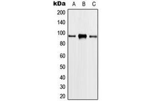 Western blot analysis of PLA2G4A expression in HeLa (A), THP1 (B), NIH3T3 (C) whole cell lysates. (PLA2G4A antibody  (Center))