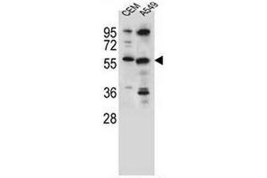 CSAD Antibody (Center) western blot analysis in CEM,A549 cell line lysates (35µg/lane). (CSAD antibody  (Middle Region))