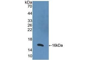 Detection of Recombinant RARa, Human using Polyclonal Antibody to Retinoic Acid Receptor Alpha (RARa) (Retinoic Acid Receptor alpha antibody  (AA 68-173))