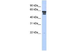 WB Suggested Anti-BLMH Antibody Titration: 0. (BLMH antibody  (Middle Region))