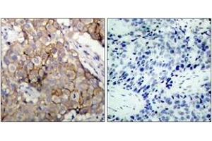 Immunohistochemistry (IHC) image for anti-Epidermal Growth Factor Receptor (EGFR) (AA 1061-1110) antibody (ABIN2888974) (EGFR antibody  (AA 1061-1110))