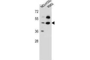 Western Blotting (WB) image for anti-Leprecan-Like 4 (LEPREL4) antibody (ABIN5016836) (Leprecan-Like 4 antibody)