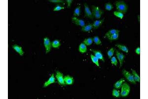 Immunofluorescent analysis of HepG2 cells using ABIN7173558 at dilution of 1:100 and Alexa Fluor 488-congugated AffiniPure Goat Anti-Rabbit IgG(H+L) (TPM3 antibody  (AA 18-224))