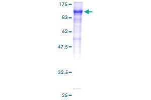 Image no. 1 for Coagulation Factor XIII, A1 Polypeptide (F13A1) (AA 1-732) protein (GST tag) (ABIN1353305) (F13A1 Protein (AA 1-732) (GST tag))