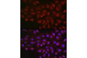 Immunofluorescence analysis of  cells using BDKRB1 Rabbit pAb (ABIN7265910) at dilution of 1:250 (40x lens). (BDKRB1 antibody  (AA 1-100))