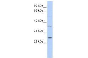 Image no. 1 for anti-IQ Motif Containing F1 (IQCF1) (AA 72-121) antibody (ABIN6741200) (IQCF1 antibody  (AA 72-121))