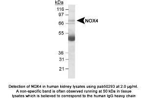 Image no. 1 for anti-NADPH Oxidase 4 (NOX4) (AA 100-200) antibody (ABIN363602) (NADPH Oxidase 4 antibody  (AA 100-200))