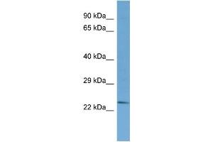 Western Blotting (WB) image for anti-tRNA-YW Synthesizing Protein 3 Homolog (TYW3) (N-Term) antibody (ABIN2500895) (TYW3 antibody  (N-Term))