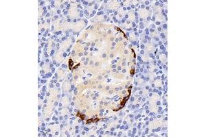Immunohistochemistry of paraffin embedded rat pancreas using GLP1 (ABIN7074053) at dilution of 1:800 (400x lens) (GLP-1 antibody)