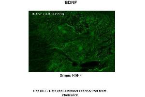 Immunohistochemistry (IHC) image for anti-Brain-Derived Neurotrophic Factor (BDNF) (Middle Region) antibody (ABIN502195) (BDNF antibody  (Middle Region))
