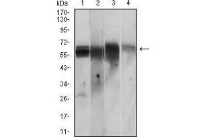 CAMKII gamma anticorps  (AA 322-481)