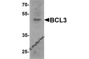 Western Blotting (WB) image for anti-B-Cell CLL/lymphoma 3 (BCL3) (C-Term) antibody (ABIN1077425) (BCL3 antibody  (C-Term))