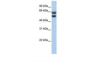Image no. 1 for anti-Zinc Finger Protein 331 (ZNF331) (AA 51-100) antibody (ABIN6737784) (ZNF331 antibody  (AA 51-100))