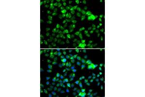 Immunofluorescence analysis of A-549 cells using NAA20 antibody. (NAT5 antibody  (AA 49-178))
