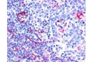 Immunohistochemistry (IHC) image for anti-Neuroepithelial Cell Transforming 1 (NET1) (C-Term) antibody (ABIN2465993) (NET1 antibody  (C-Term))