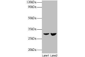 Western blot All lanes: UQCRFS1 antibody at 2 μg/mL Lane 1: EC109 whole cell lysate Lane 2: 293T whole cell lysate Secondary Goat polyclonal to rabbit IgG at 1/15000 dilution Predicted band size: 30 kDa Observed band size: 30 kDa (UQCRFS1 antibody  (AA 79-274))