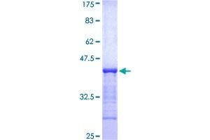 Image no. 1 for Ubiquitin Specific Peptidase 6 (USP6) (AA 2-89) protein (GST tag) (ABIN1324843) (USP6 Protein (AA 2-89) (GST tag))