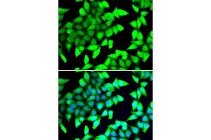 Immunofluorescence analysis of A549 cells using HDAC5 antibody. (HDAC5 antibody  (AA 350-450))