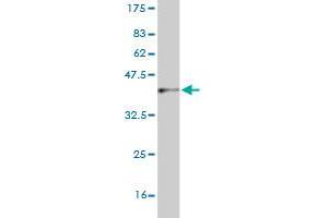 Western Blot detection against Immunogen (37. (CNDP2 antibody  (AA 191-300))