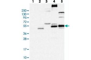 Western blot analysis of Lane 1: RT-4, Lane 2: U-251 MG, Lane 3: Human Plasma, Lane 4: Liver, Lane 5: Tonsil with FLVCR2 polyclonal antibody .