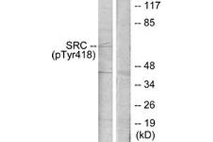 Western blot analysis of extracts from COLO205 cells treated with serum 15% 10', using Src (Phospho-Tyr418) Antibody. (Src antibody  (pTyr419))