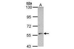 Image no. 1 for anti-Cytochrome P450, Family 21, Subfamily A, Polypeptide 2 (CYP21A2) (AA 120-386) antibody (ABIN467561)