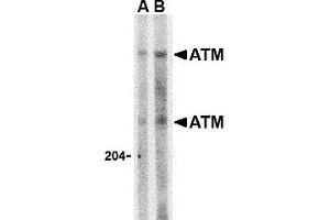 Western Blotting (WB) image for anti-Ataxia Telangiectasia Mutated (ATM) (C-Term) antibody (ABIN1030266) (ATM antibody  (C-Term))