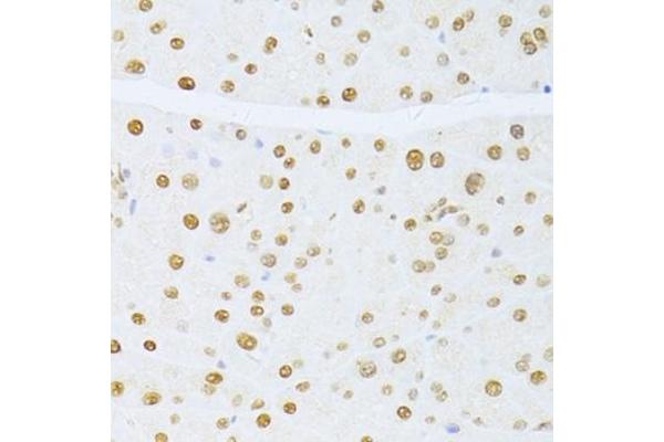 ETV1 antibody  (AA 80-300)