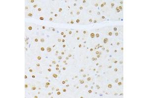 Immunohistochemistry of paraffin-embedded mouse pancreas using ETV1 antibody (ABIN6129794, ABIN6140327, ABIN6140329 and ABIN6217250) at dilution of 1:100 (40x lens). (ETV1 antibody  (AA 80-300))