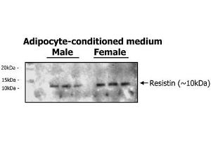 Immunoblot analysis of adipocyte-conditioned medium from human male and female with different Resistin expression levels using anti-Resistin (human), pAb . (Resistin antibody)