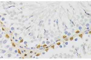 Immunohistochemistry of paraffin-embedded Rat testis using ELAC2 Polyclonal Antibody at dilution of 1:200 (40x lens).