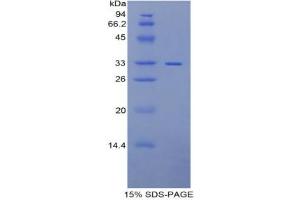 SDS-PAGE analysis of Rat MP1 Protein.