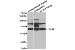 Western Blotting (WB) image for anti-Nicotinic Acetylcholine Receptor beta (CHRNB1) antibody (ABIN1876483) (CHRNB1 antibody)