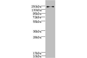 Western blot All lanes: PLA2R1 antibody IgG at 0. (PLA2R1 antibody  (AA 870-1130))