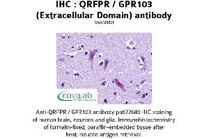 Image no. 1 for anti-Pyroglutamylated RFamide Peptide Receptor (QRFPR) (2nd Extracellular Domain) antibody (ABIN1738665) (QRFPR antibody  (2nd Extracellular Domain))